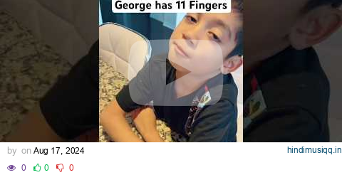 We Found Out Our Son Has an Extra Finger!! #short #shorts #shortsvideo pagalworld mp3 song download