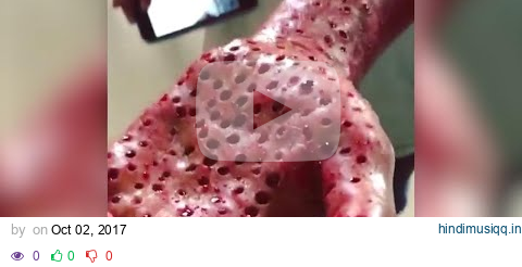 Do You Have Trypophobia The Fear of Holes? | The Doctors pagalworld mp3 song download