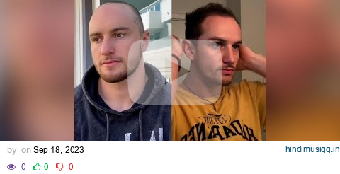 TikTok influencer who started losing hair at 19 breaks stigma around male hair loss l GMA pagalworld mp3 song download