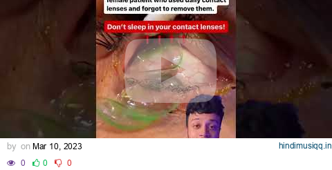 NEVER SLEEP WITH YOUR CONTACT LENSES🤯😨 #shorts #mbbs #neet | Raj Bhosle pagalworld mp3 song download