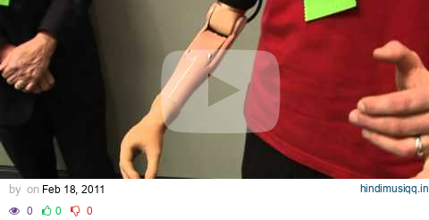 Mind-moved bionic arm helps vet use hand again pagalworld mp3 song download