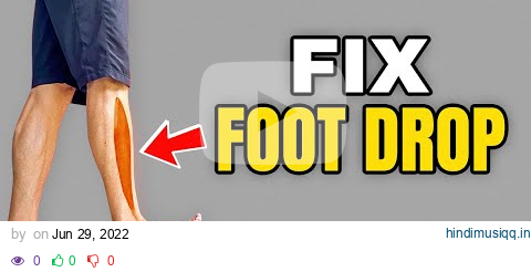 3 Exercises to Correct Foot Drop pagalworld mp3 song download