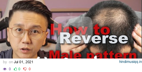 How to Reverse Male Pattern Baldness - Hair Loss in Men pagalworld mp3 song download