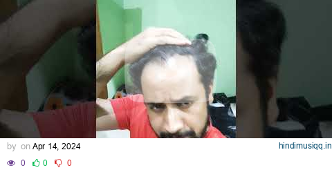 after using minoxidil #hairfall #hairstyle #haircare #minoxidil #song pagalworld mp3 song download